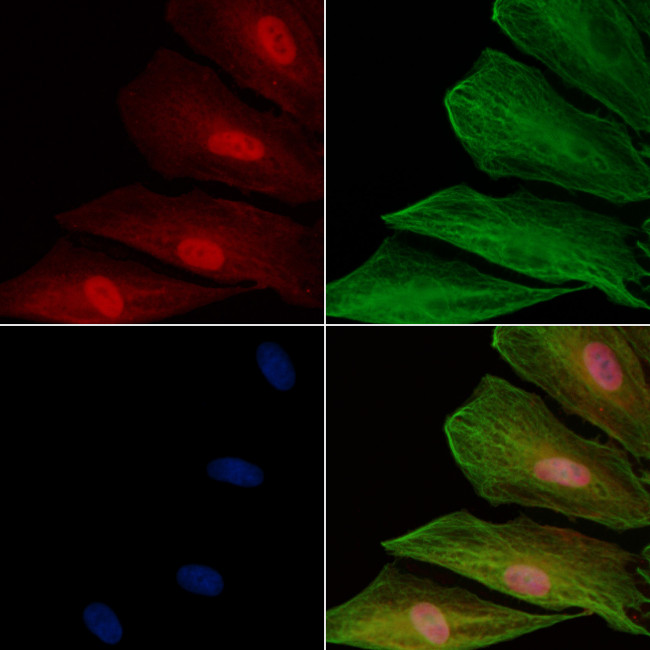 HUS1 Antibody in Immunocytochemistry (ICC/IF)