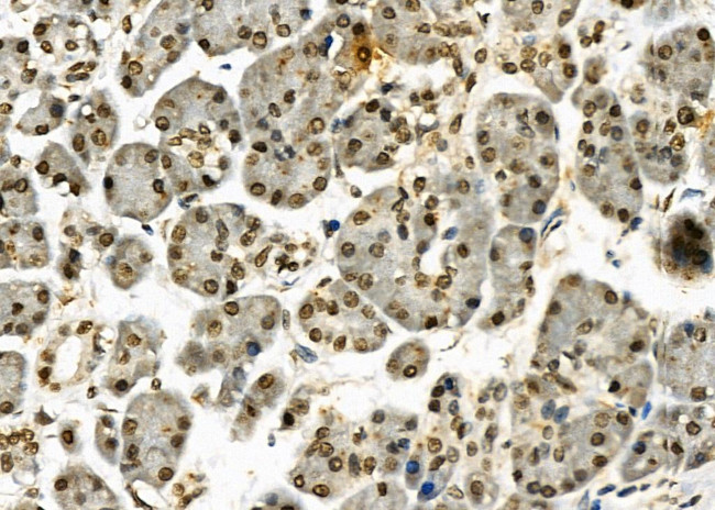 HEC1 Antibody in Immunohistochemistry (Paraffin) (IHC (P))