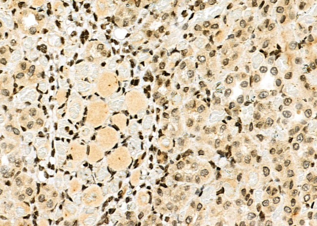 HEC1 Antibody in Immunohistochemistry (Paraffin) (IHC (P))