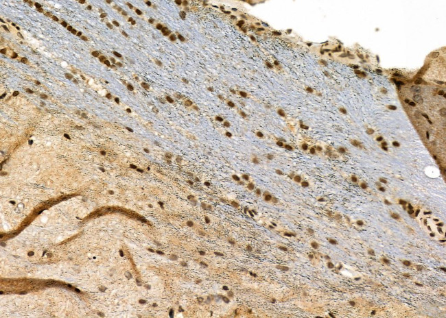 HEC1 Antibody in Immunohistochemistry (Paraffin) (IHC (P))