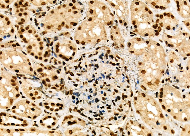 HEC1 Antibody in Immunohistochemistry (Paraffin) (IHC (P))