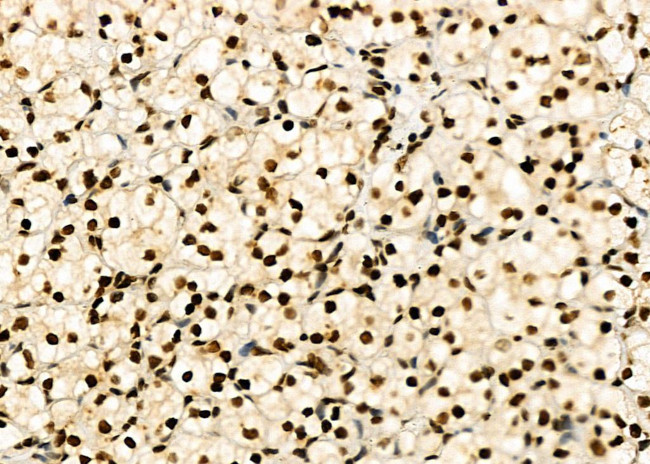 HEC1 Antibody in Immunohistochemistry (Paraffin) (IHC (P))