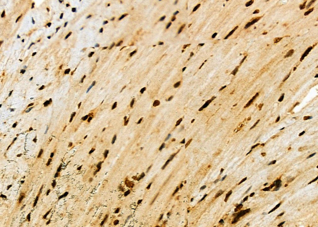 HEC1 Antibody in Immunohistochemistry (Paraffin) (IHC (P))