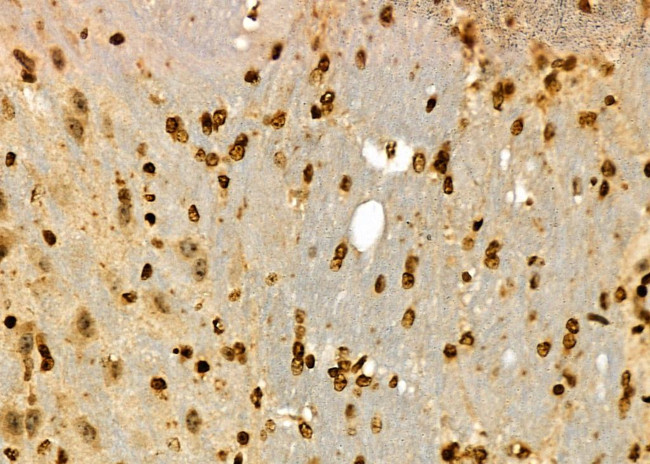 HEC1 Antibody in Immunohistochemistry (Paraffin) (IHC (P))