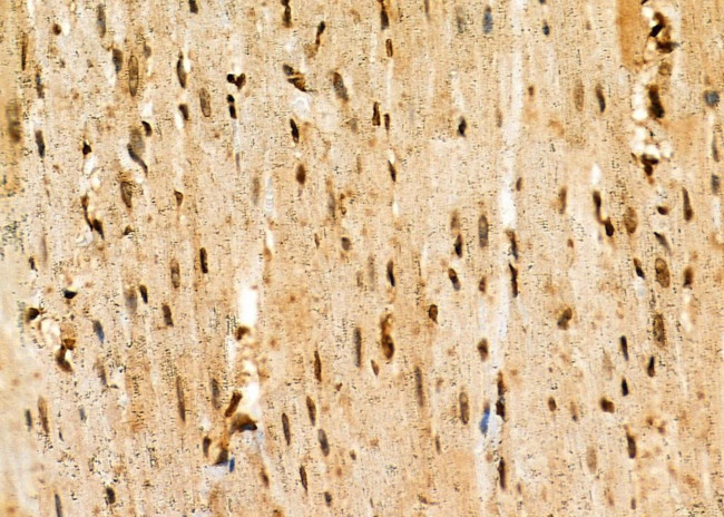 HEC1 Antibody in Immunohistochemistry (Paraffin) (IHC (P))