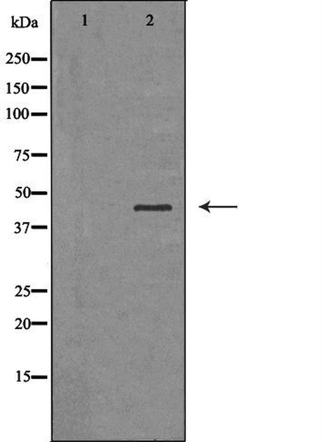 SERPINB3 Antibody in Western Blot (WB)