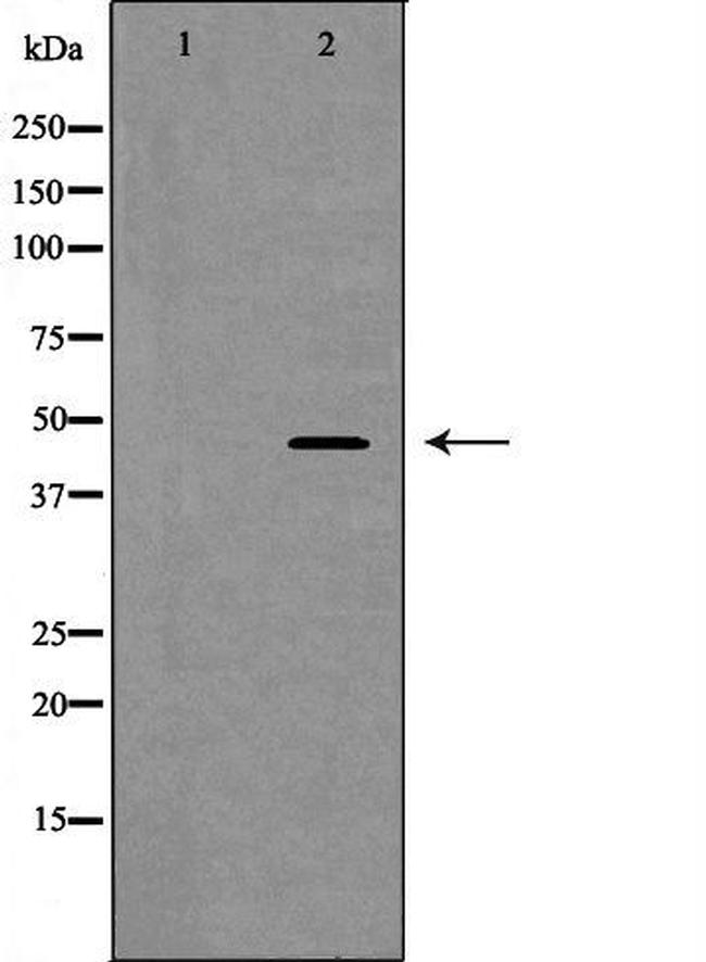 DP1 Antibody in Western Blot (WB)