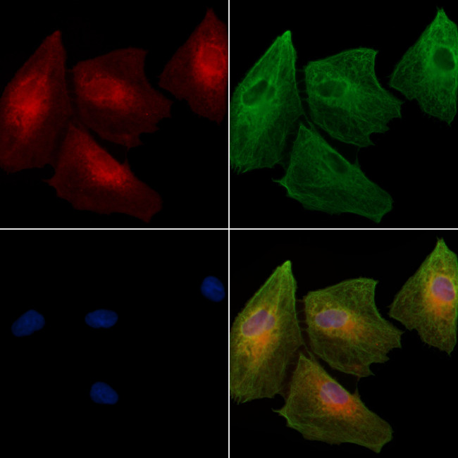 APRT Antibody in Immunocytochemistry (ICC/IF)