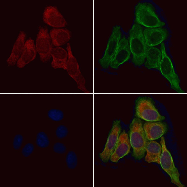 MTH1 Antibody in Immunocytochemistry (ICC/IF)