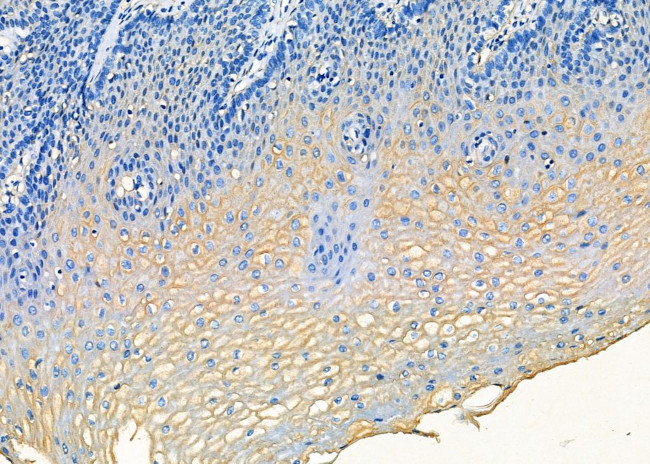 MTH1 Antibody in Immunohistochemistry (Paraffin) (IHC (P))