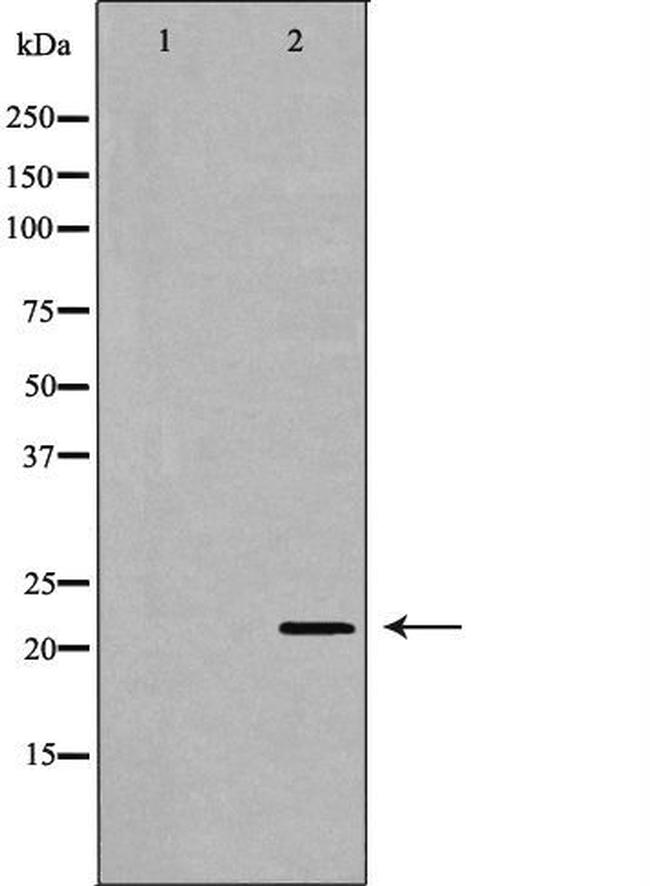 MTH1 Antibody in Western Blot (WB)