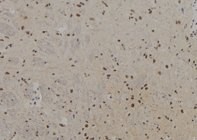 PFKM Antibody in Immunohistochemistry (Paraffin) (IHC (P))