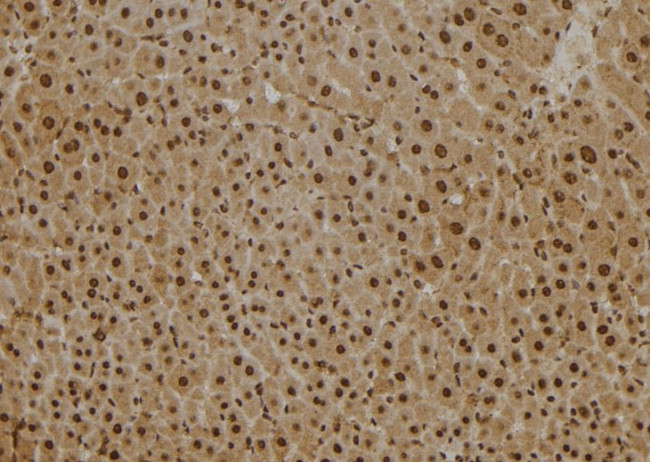 PSMB2 Antibody in Immunohistochemistry (Paraffin) (IHC (P))