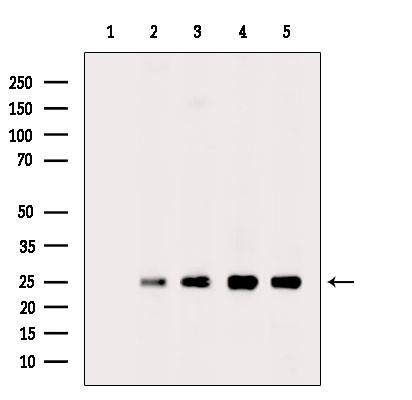 PSMB2 Antibody in Western Blot (WB)