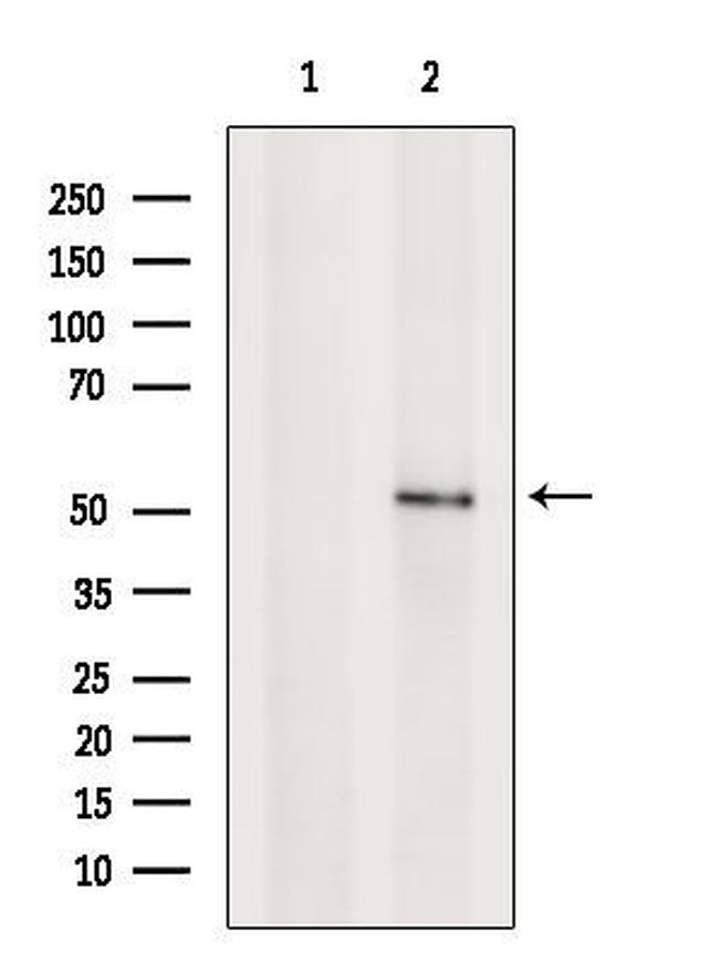 SEMG1 Antibody in Western Blot (WB)