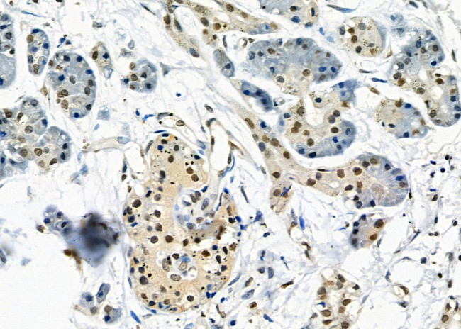 UBD Antibody in Immunohistochemistry (Paraffin) (IHC (P))