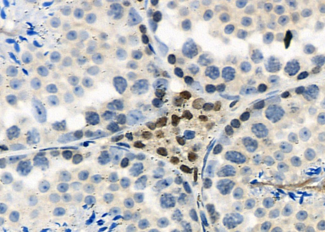 UBD Antibody in Immunohistochemistry (Paraffin) (IHC (P))