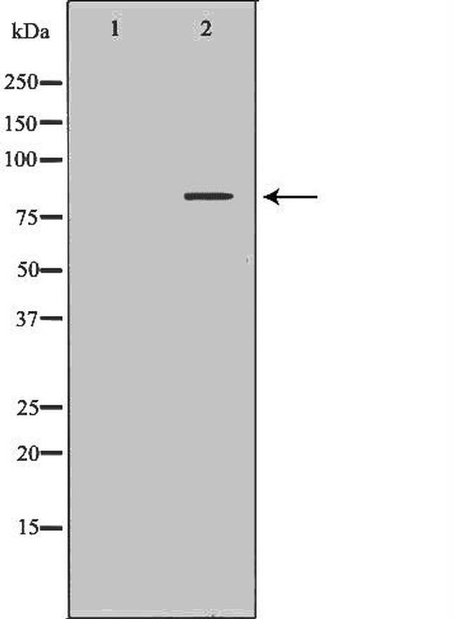 SLC3A1 Antibody in Western Blot (WB)