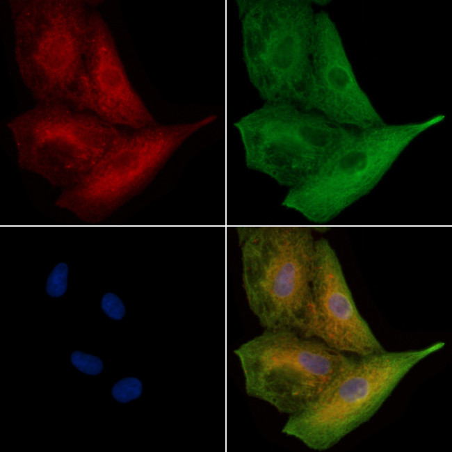 UGT1A4 Antibody in Immunocytochemistry (ICC/IF)