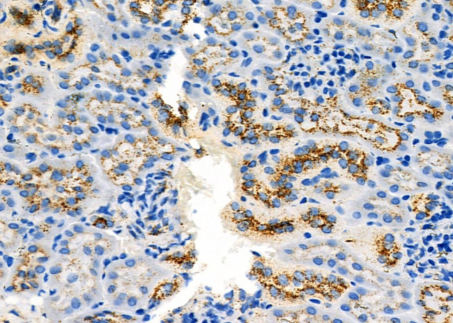 UGT1A4 Antibody in Immunohistochemistry (Paraffin) (IHC (P))