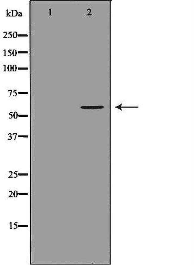 UGT1A4 Antibody in Western Blot (WB)