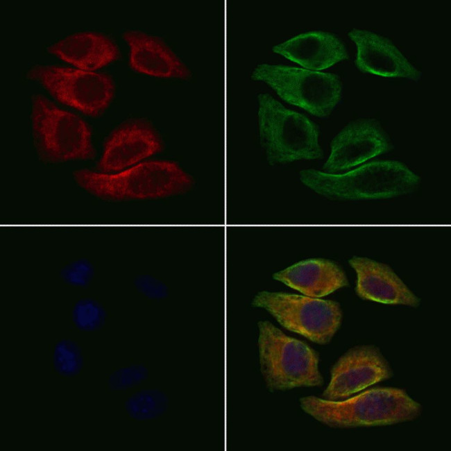 PNMT Antibody in Immunocytochemistry (ICC/IF)