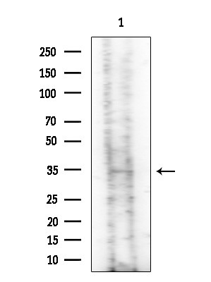 PNMT Antibody in Western Blot (WB)