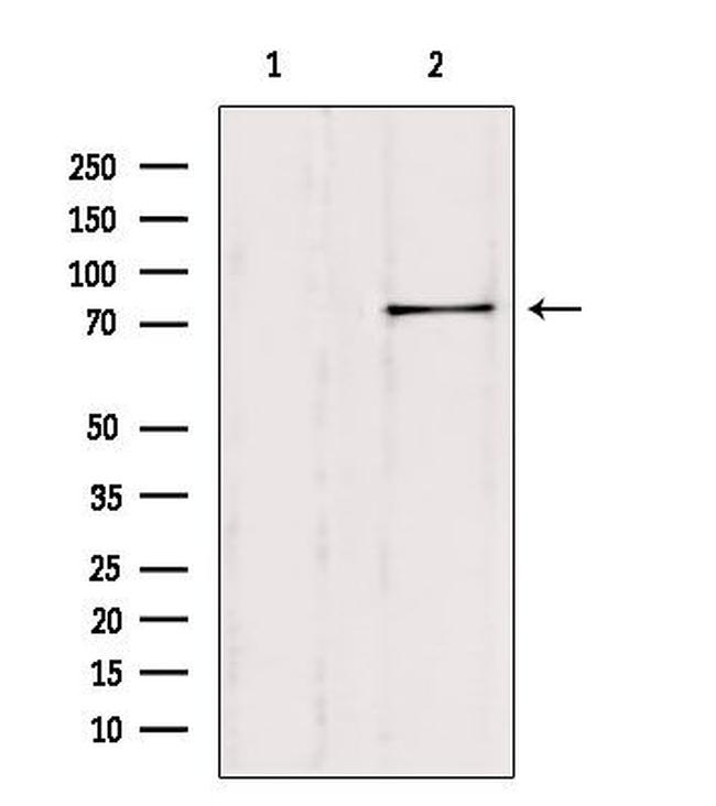 SH2B1 Antibody in Western Blot (WB)