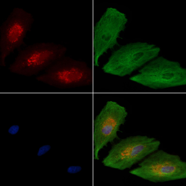 WNK3 Antibody in Immunocytochemistry (ICC/IF)