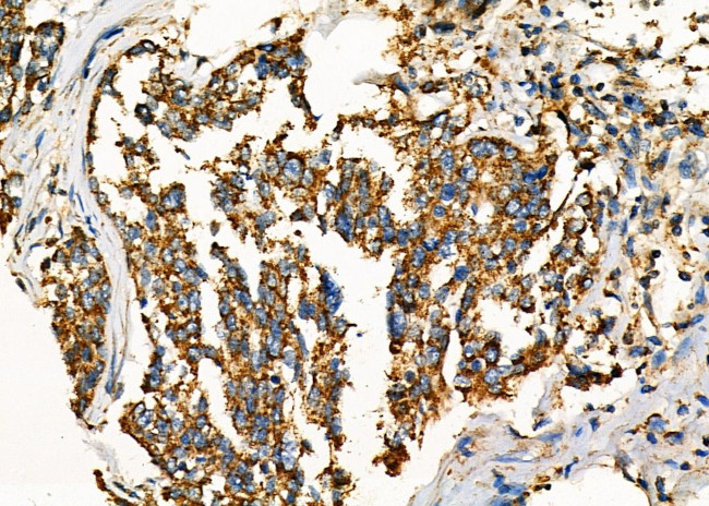 WNK3 Antibody in Immunohistochemistry (Paraffin) (IHC (P))