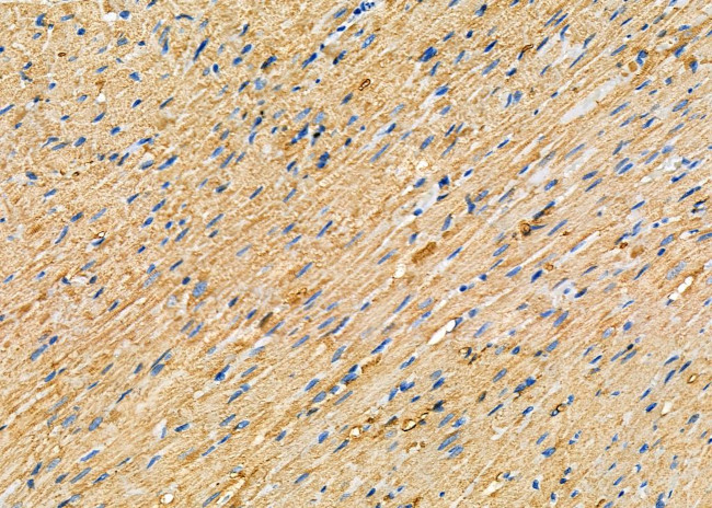 WNK3 Antibody in Immunohistochemistry (Paraffin) (IHC (P))