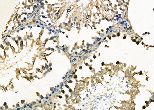 RABL2A Antibody in Immunohistochemistry (Paraffin) (IHC (P))