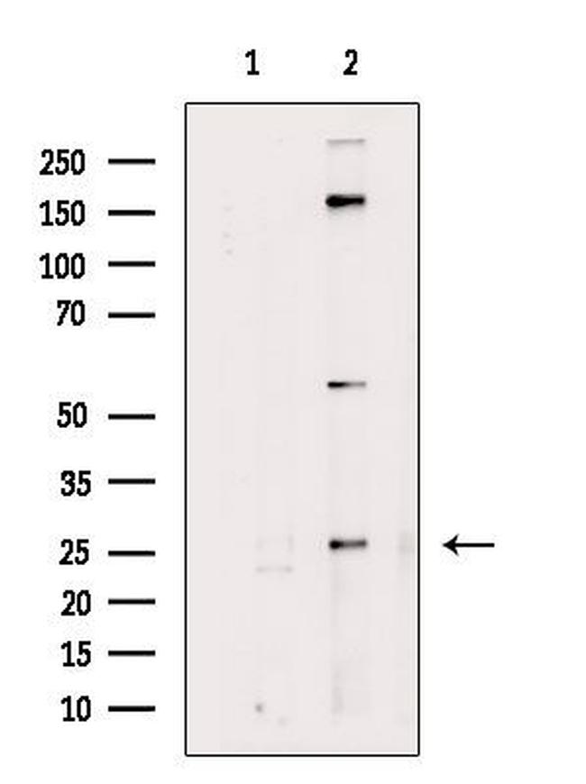 RABL2A Antibody in Western Blot (WB)