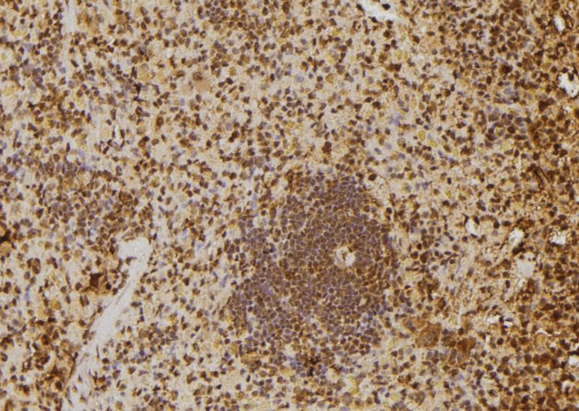 SKIV2L2 Antibody in Immunohistochemistry (Paraffin) (IHC (P))