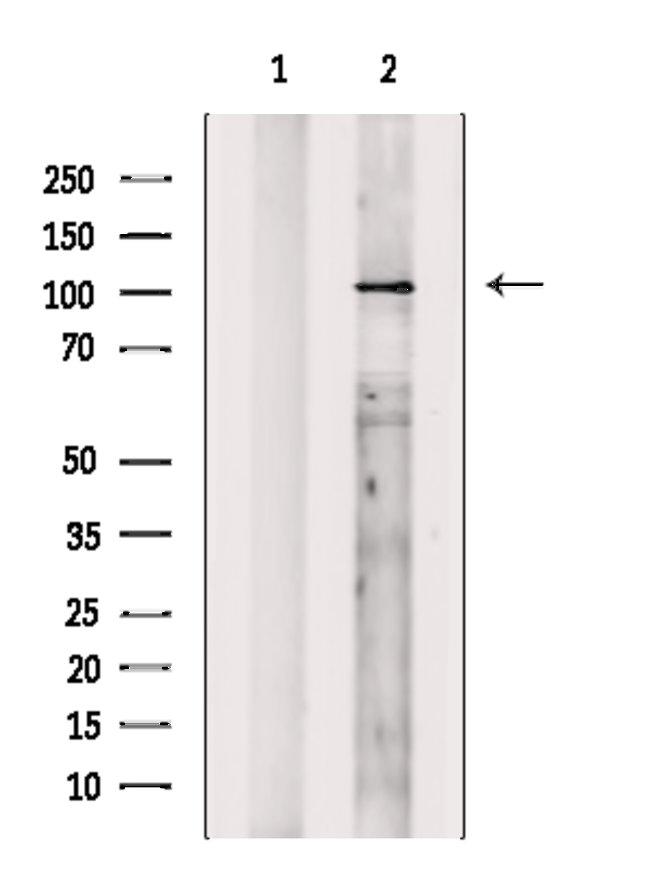 SKIV2L2 Antibody in Western Blot (WB)