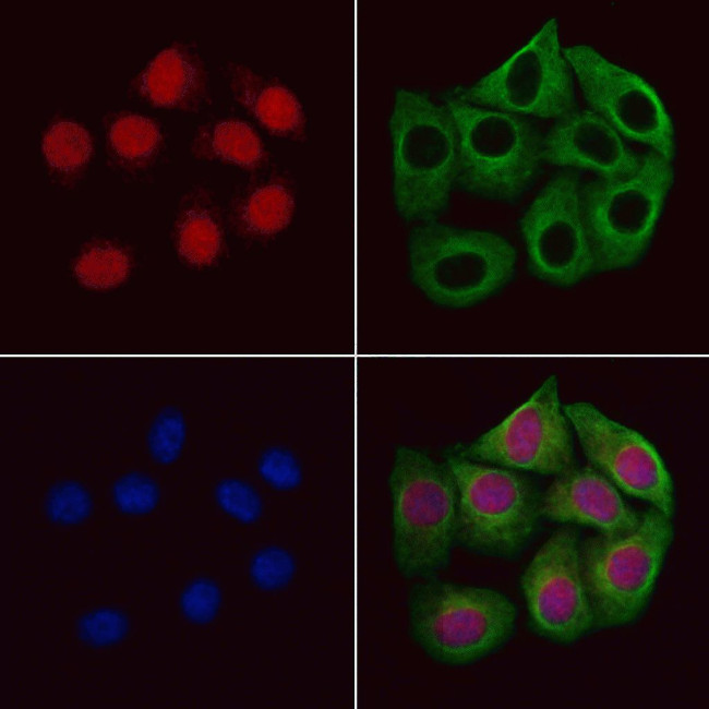 NSD3 Antibody in Immunocytochemistry (ICC/IF)