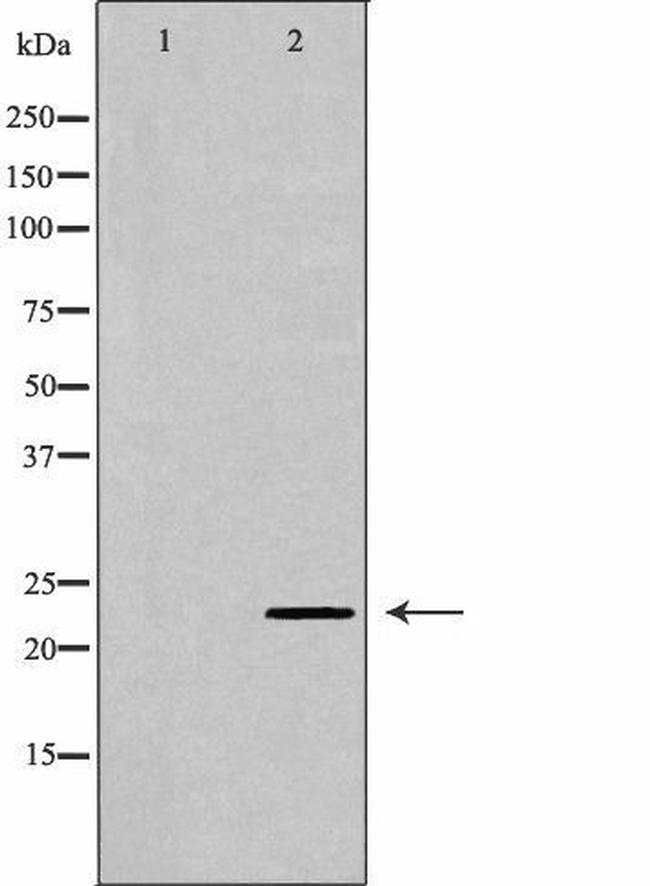 RAB6A Antibody in Western Blot (WB)