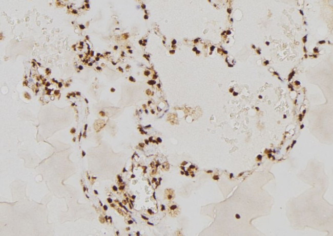 RAG2 Antibody in Immunohistochemistry (Paraffin) (IHC (P))