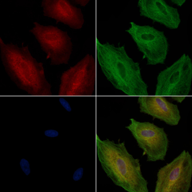 ECE1 Antibody in Immunocytochemistry (ICC/IF)