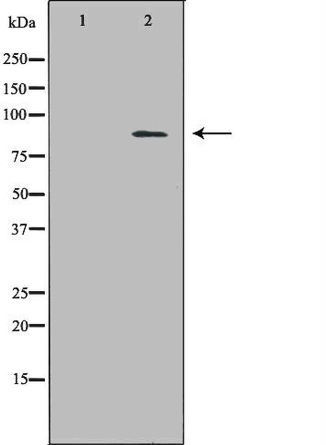 ECE1 Antibody in Western Blot (WB)