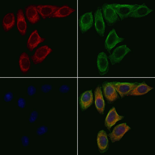 OCA2 Antibody in Immunocytochemistry (ICC/IF)