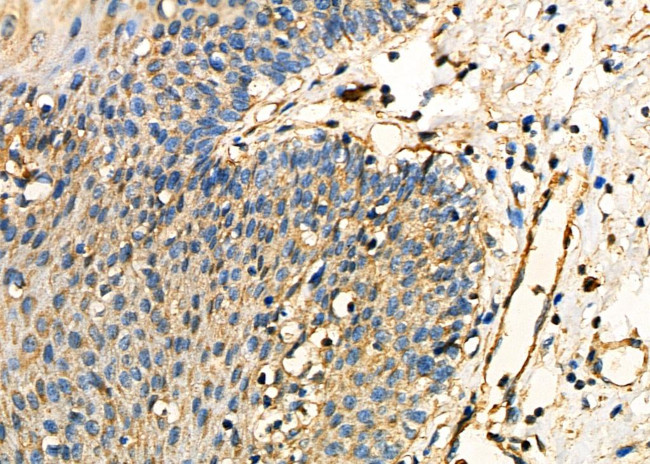 OCA2 Antibody in Immunohistochemistry (Paraffin) (IHC (P))