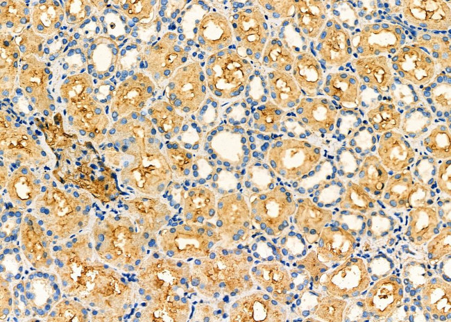 OCA2 Antibody in Immunohistochemistry (Paraffin) (IHC (P))