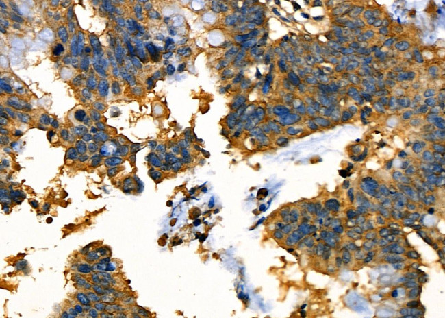 OCA2 Antibody in Immunohistochemistry (Paraffin) (IHC (P))