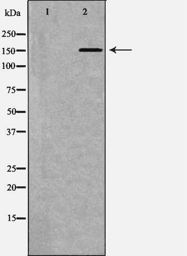 ATP7B Antibody in Western Blot (WB)