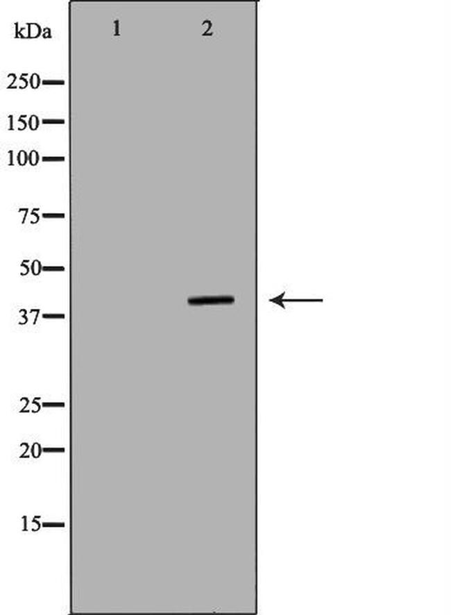 SH3GL2 Antibody in Western Blot (WB)