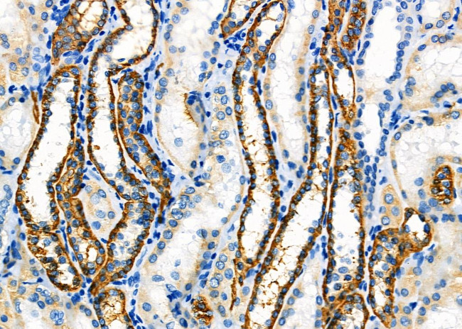 ATP1B1 Antibody in Immunohistochemistry (Paraffin) (IHC (P))