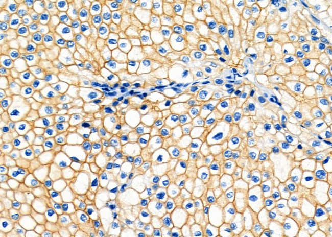 ATP1B1 Antibody in Immunohistochemistry (Paraffin) (IHC (P))