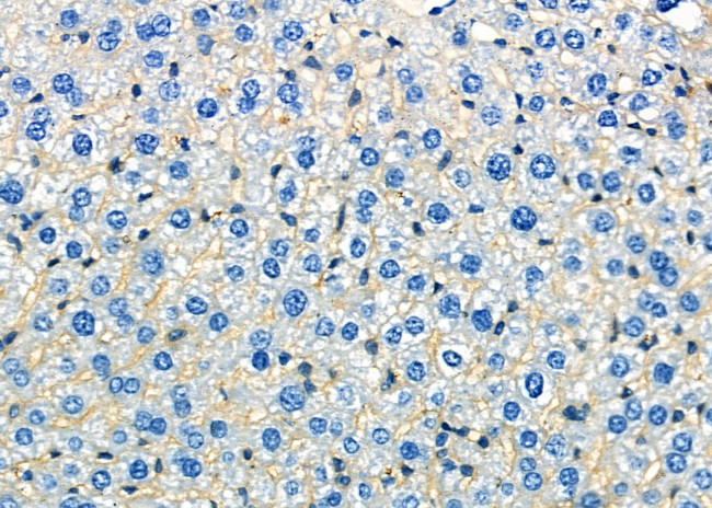 ATP1B1 Antibody in Immunohistochemistry (Paraffin) (IHC (P))