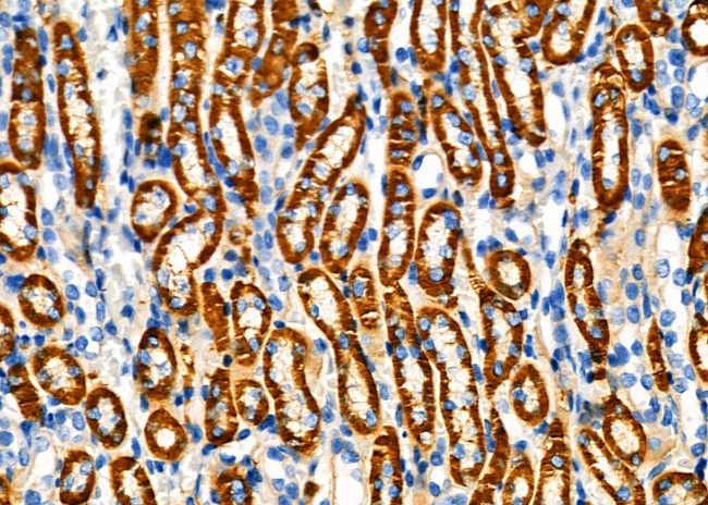 ATP1B1 Antibody in Immunohistochemistry (Paraffin) (IHC (P))